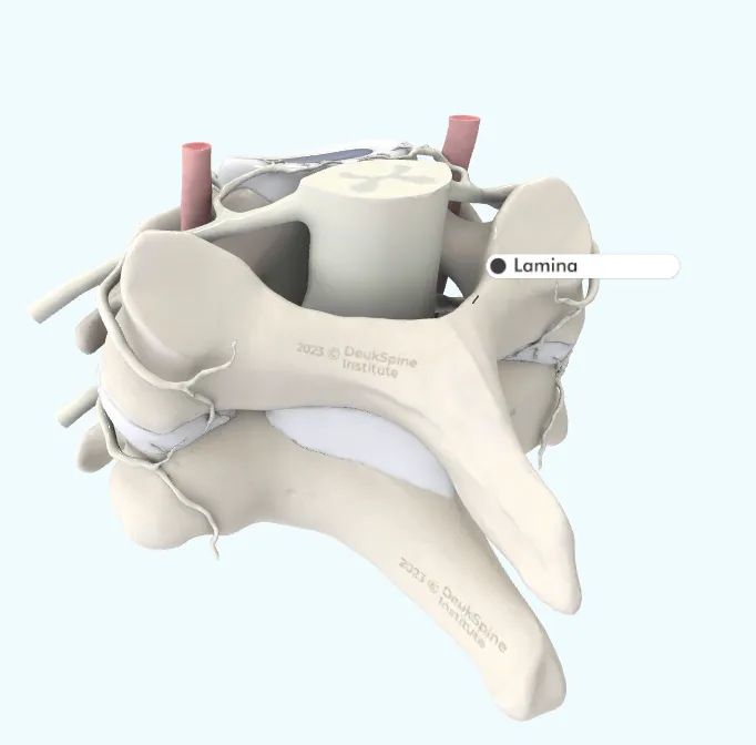 D model of a lumbar vertebra with highlighted lamina section.
