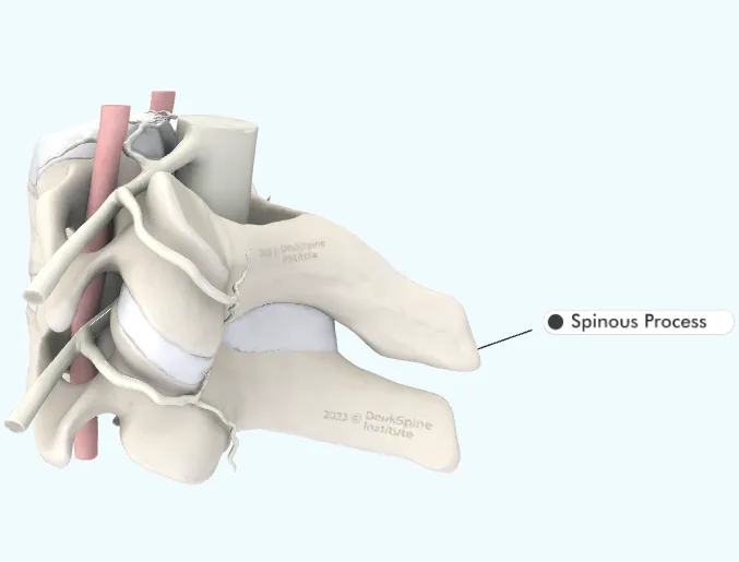 D illustration of vertebrae highlighting the spinous process.