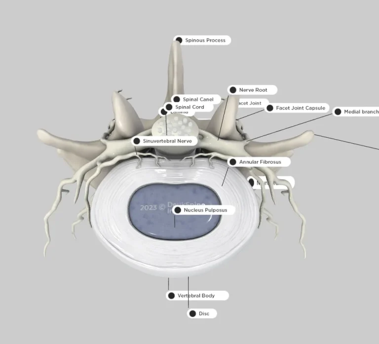 Labeled anatomical diagram of a vertebra and spinal cord from above, showing nerves and spinal components.