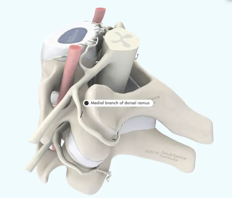 D anatomical model of a spine section highlighting the medial branch of the dorsal ramus.