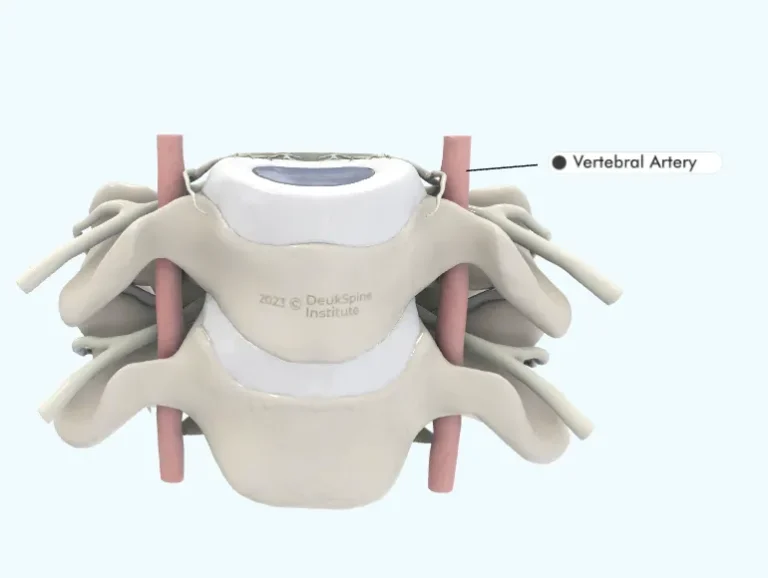 Diagram of vertebrae highlighting the vertebral artery, labeled from the DeukSpine Institute.