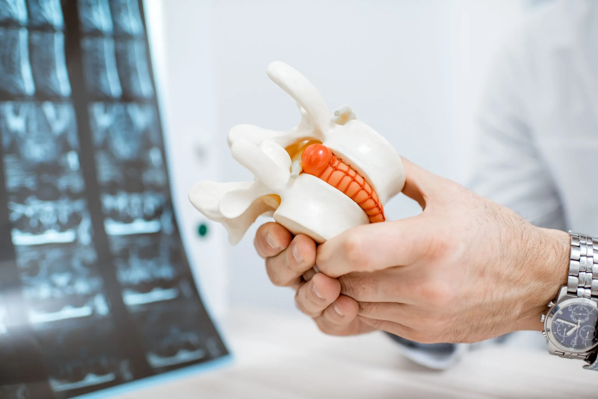 anatomical-model-of-vertebras-with-intervertebral-2021-11-02-00-15-56-utc.jpg