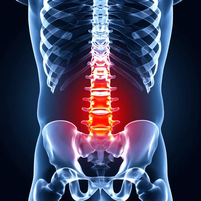 X-ray illustration of a spine with the lower back highlighted in red.