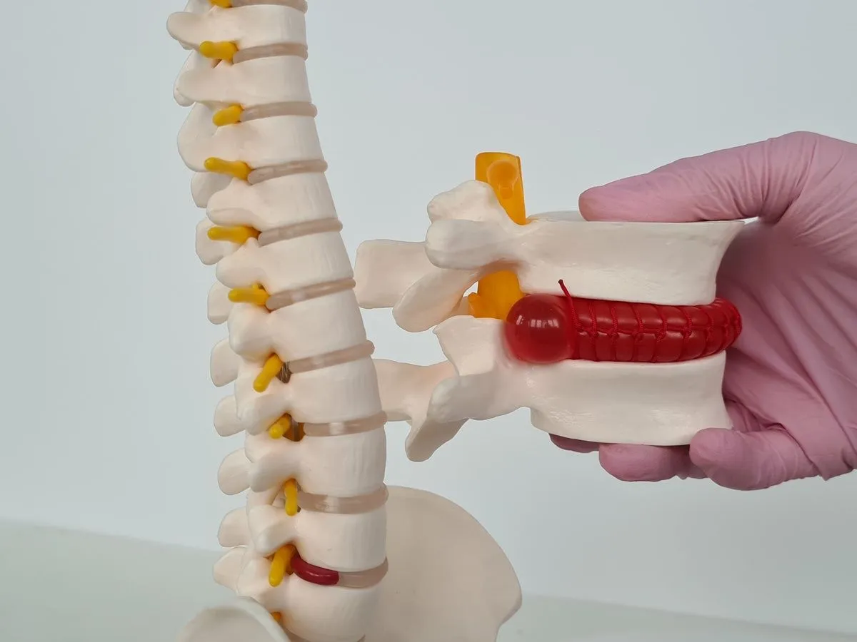 intervertebral disc