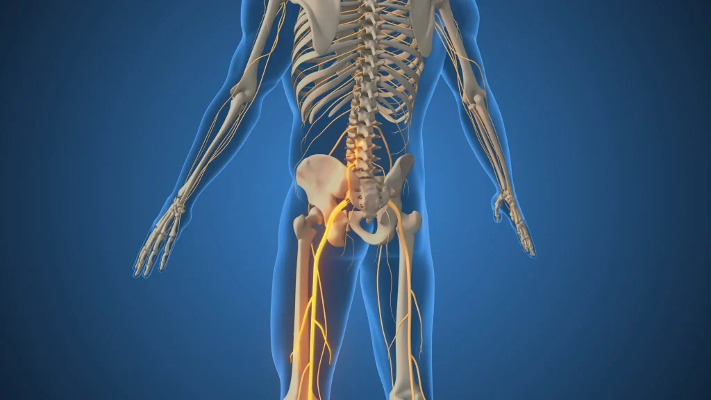 Diagram showing sciatic nerve running from spine through pelvis and legs.