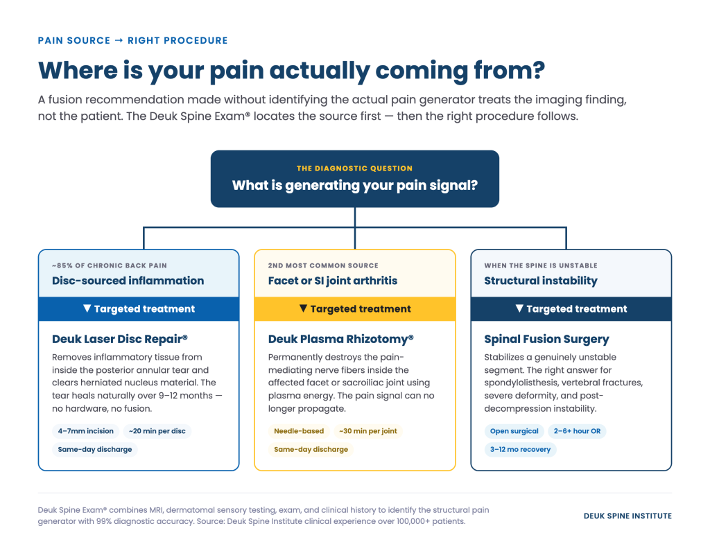 Flowchart detailing targeted treatments for chronic back pain sources: disc-sourced inflammation, joint arthritis, and structural instability.