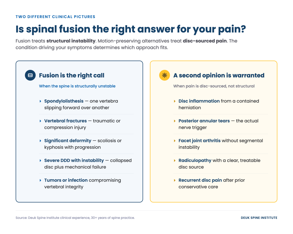 Comparison of spinal fusion and second opinion criteria for treating pain based on structural instability or disc-sourced issues.