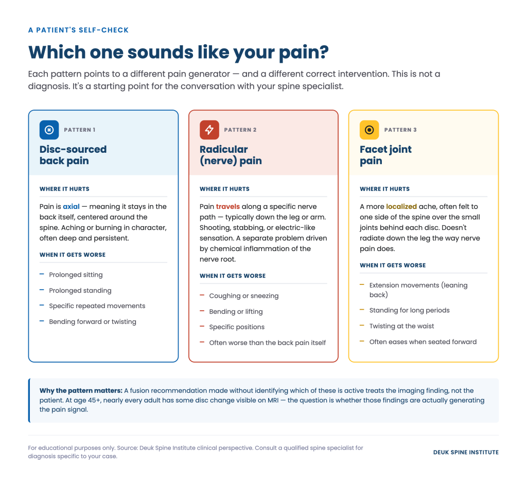 Infographic explaining three patterns of back pain with descriptions of where it hurts and what worsens each type.
