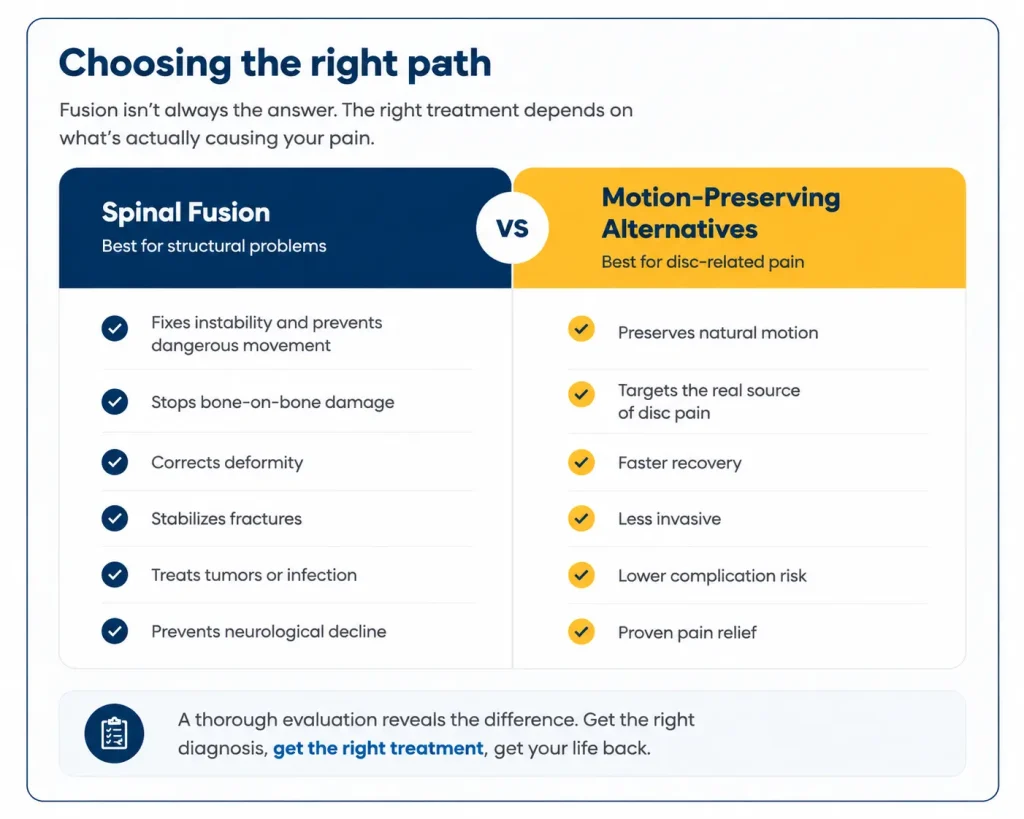 Comparison chart of spinal fusion and motion-preserving alternatives for spinal treatment options.
