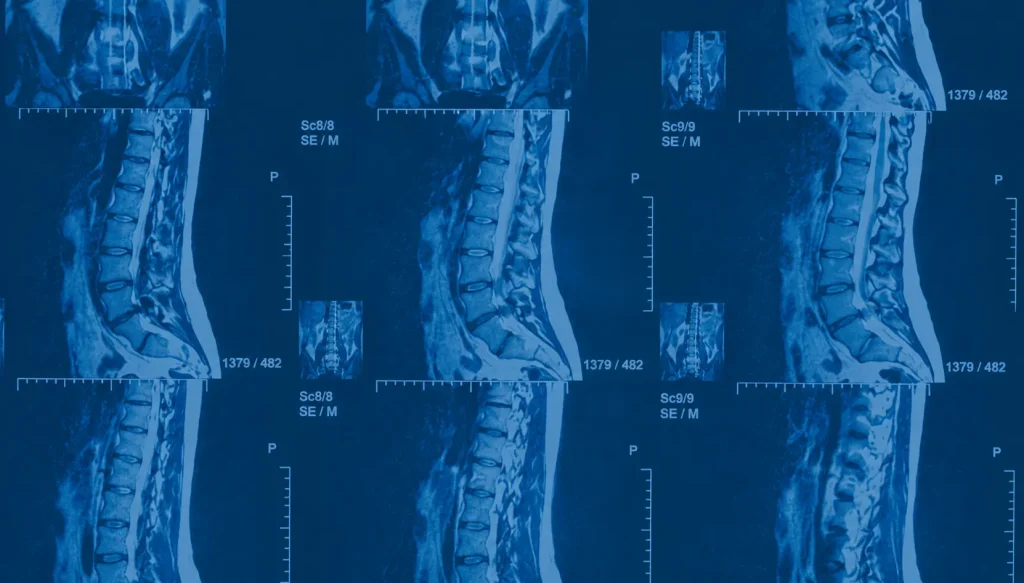 Blue-toned background featuring multiple MRI spine scan images arranged in a medical imaging grid pattern for a virtual consultation banner design.