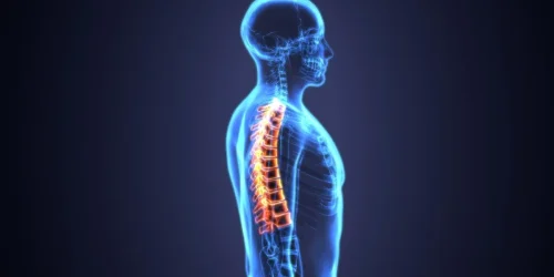 X-ray side view shows herniated disc highlighted in a glowing spine.