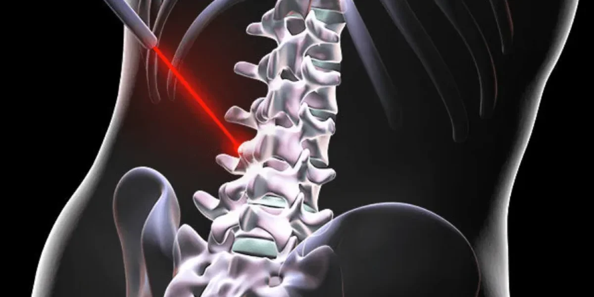 Deuk Laser Disc Repair 3.png