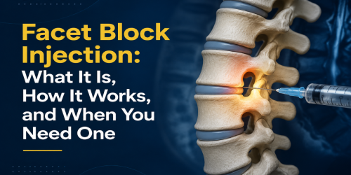 Illustration of a spine receiving a facet block injection with text explaining the procedure.