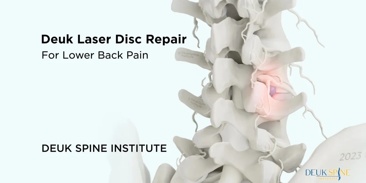 D spine model highlighting the "Deuk Laser Disc Repair" for lower back pain at Deuk Spine Institute.