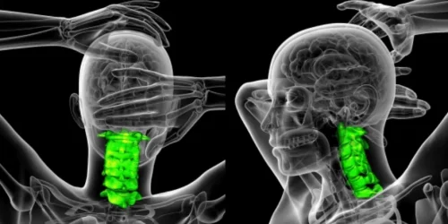 X-ray style image of two human figures showing highlighted green cervical vertebrae.