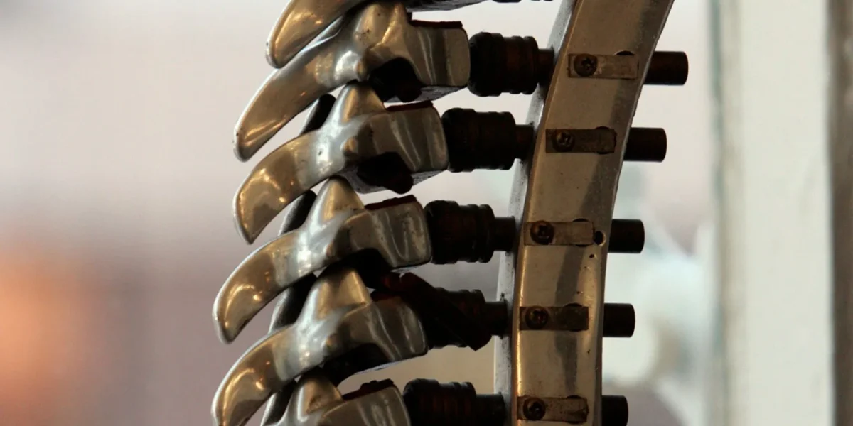 Close-up of a metal spinal model, illustrating spinal fusion surgery risks and complications.