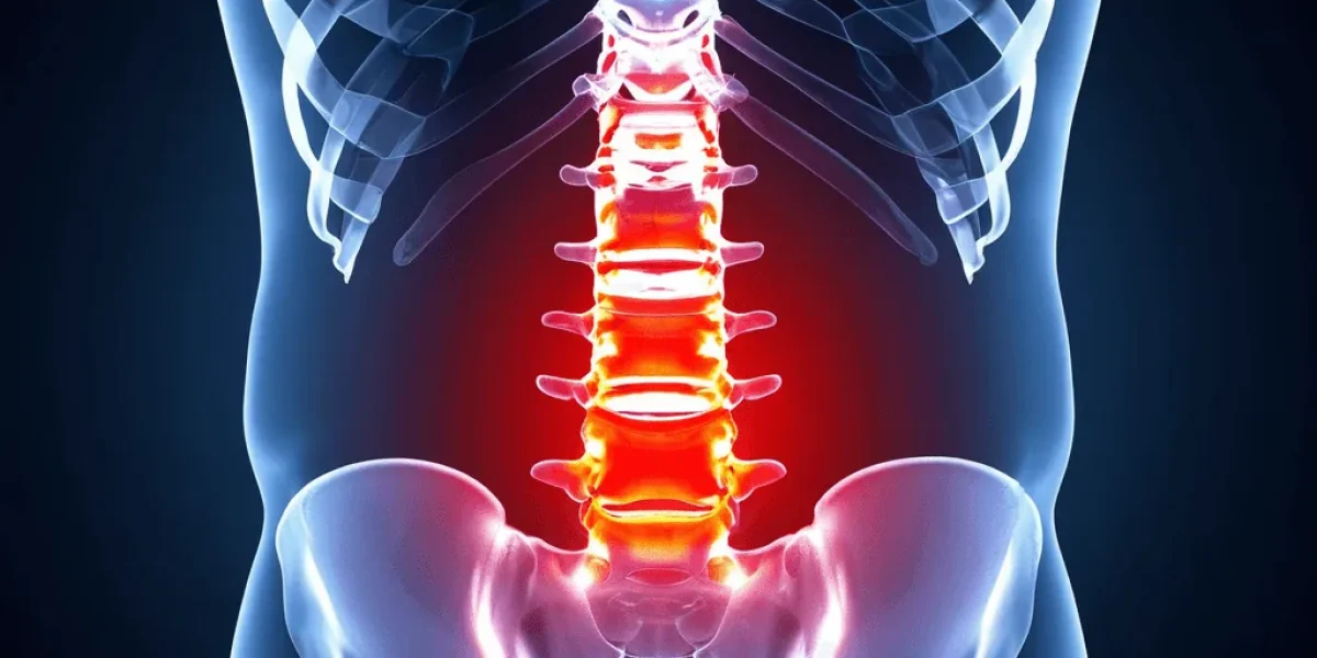 Illustration of lower back pain