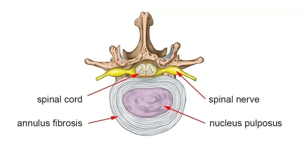 An animated cross section of spine showing disc, spinal cord, annulus fibrosus etc.