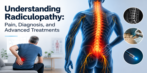 Illustration of radiculopathy with highlighted spine, man in pain, and treatment images.