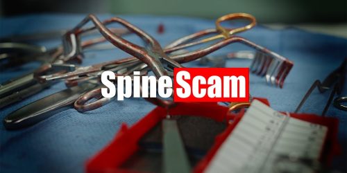 Surgical tools on a tray with the text "Spine Scam" overlaid.